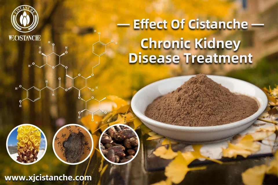 chronic kidney diseae treatment